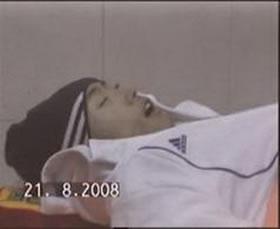 17-годишният син на практикуваща Фалун Гонг починал на 20 август 2008 г., вследствие тормоза на китайските власти, затова, че майката е практикуваща Фалун Гонг.