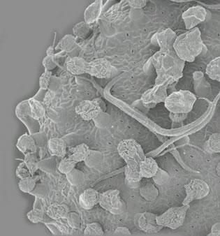 Снимка, направена с електронен микроскоп, на листната повърхност на растението Филкоксия, показваща жлези и нематоди.