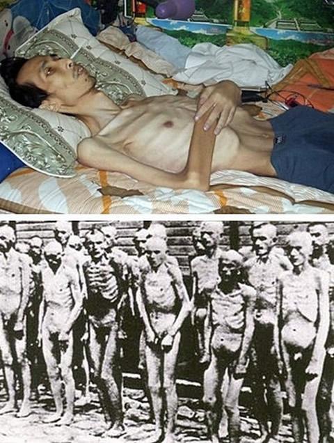 Затворници в китайски лагери. На снимката горе: Чен Джянджун, практикуващ Фалун Гонг, след затваряне в лагер. На снимката долу: затворници в нацисткия лагер Аушвиц. 