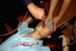 Пресъздаване на насилствено хранене на Фалун Гонг практикуващи в центрове за задържане.